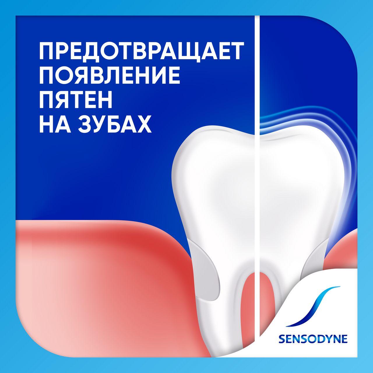 Зубная паста Sensodyne Экстра отбеливание 75 мл